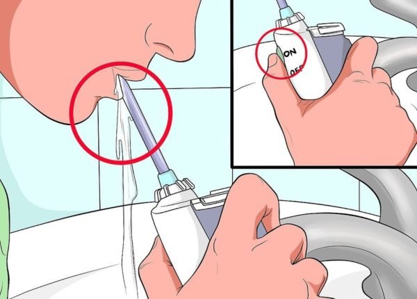 Очистка ротовой полости с открытым ртом